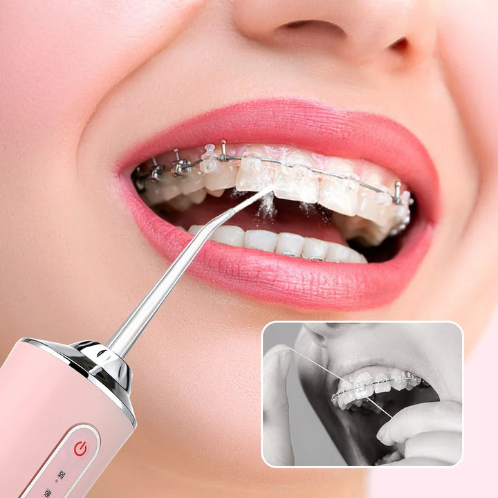 AquaSmile™ 🦷 Irrigador Bucal Recargable