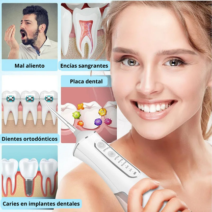 AquaSmile™ 🦷 Irrigador Bucal Recargable