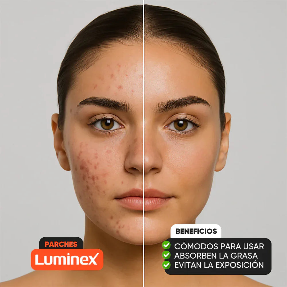 Pack de 48 Parches Anti-Acne Circulares 2X1 | Luminex