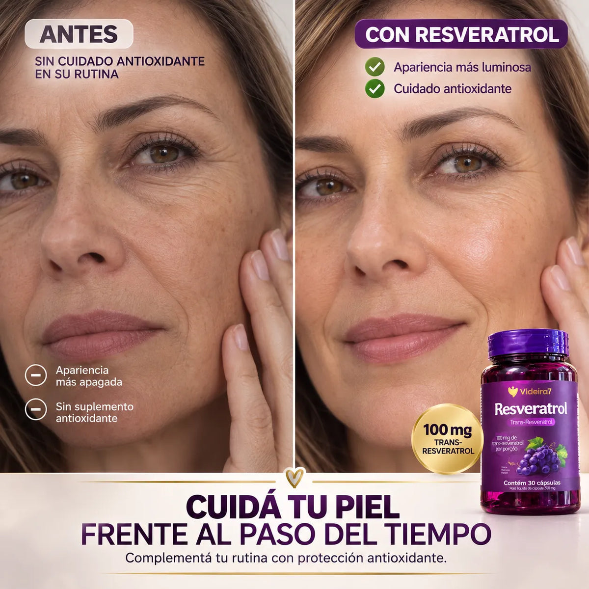 Resveratrol - Videira7